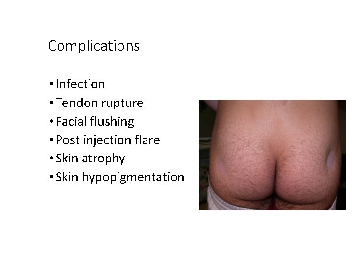 Complications • Infection • Tendon rupture • Facial flushing • Post injection flare •