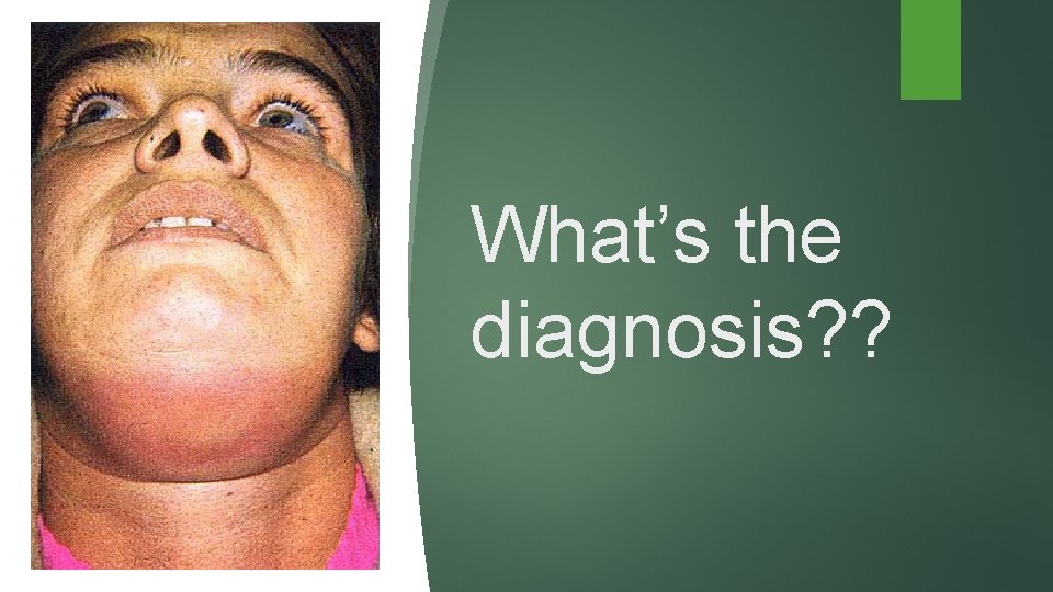 What’s the diagnosis? ? 