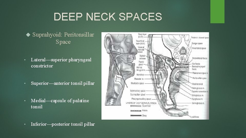 DEEP NECK SPACES Suprahyoid: Peritonsillar Space • Lateral—superior pharyngeal constrictor • Superior—anterior tonsil pillar