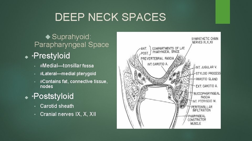 DEEP NECK SPACES Suprahyoid: Parapharyngeal Space " Prestyloid • #Medial—tonsillar fossa • #Lateral—medial pterygoid