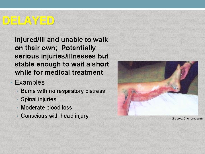 DELAYED Injured/ill and unable to walk on their own; Potentially serious injuries/illnesses but stable
