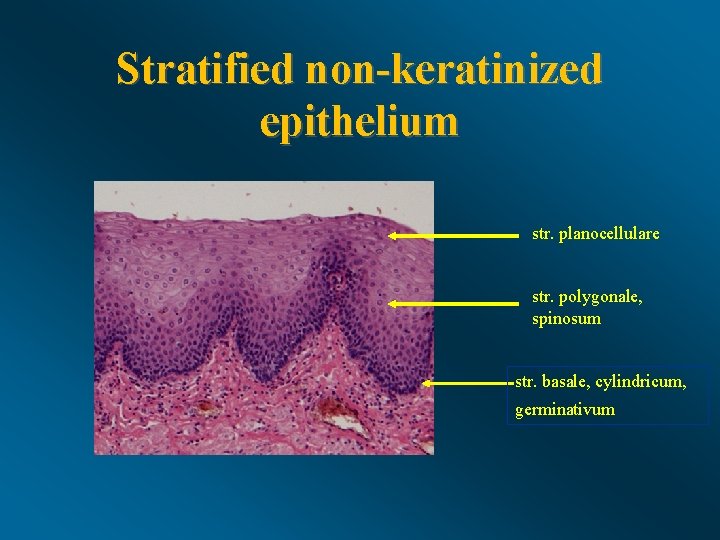 Stratified non-keratinized epithelium str. planocellulare str. polygonale, spinosum str. basale, cylindricum, germinativum 