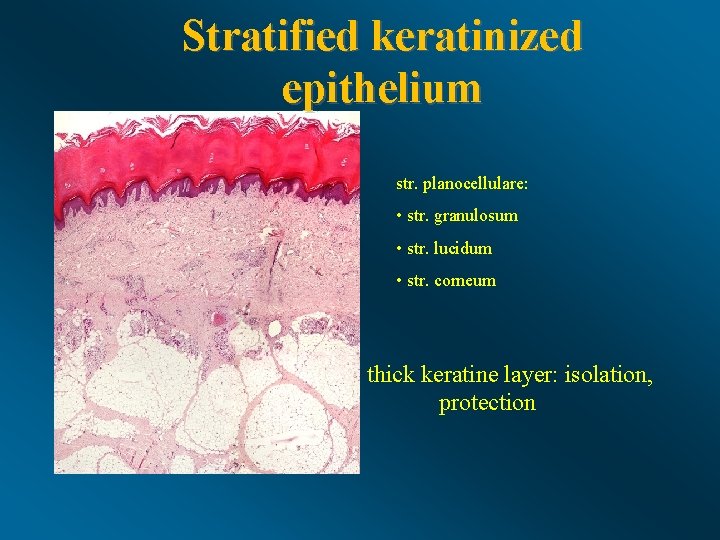 Stratified keratinized epithelium str. planocellulare: • str. granulosum • str. lucidum • str. corneum
