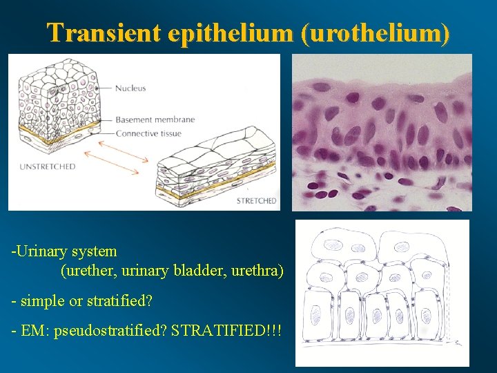 Transient epithelium (urothelium) -Urinary system (urether, urinary bladder, urethra) - simple or stratified? -