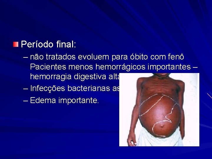 Período final: – não tratados evoluem para óbito com fenô Pacientes menos hemorrágicos importantes