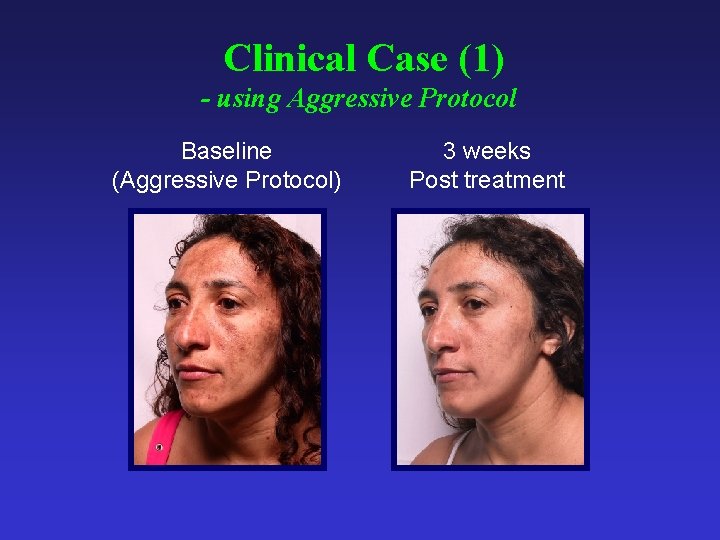 Clinical Case (1) - using Aggressive Protocol Baseline (Aggressive Protocol) 3 weeks Post treatment