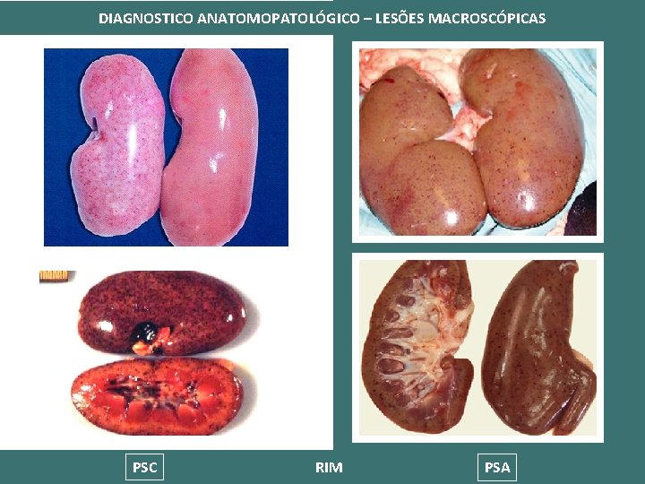 DIAGNOSTICO ANATOMOPATOLÓGICO – LESÕES MACROSCÓPICAS PSC RIM PSA 