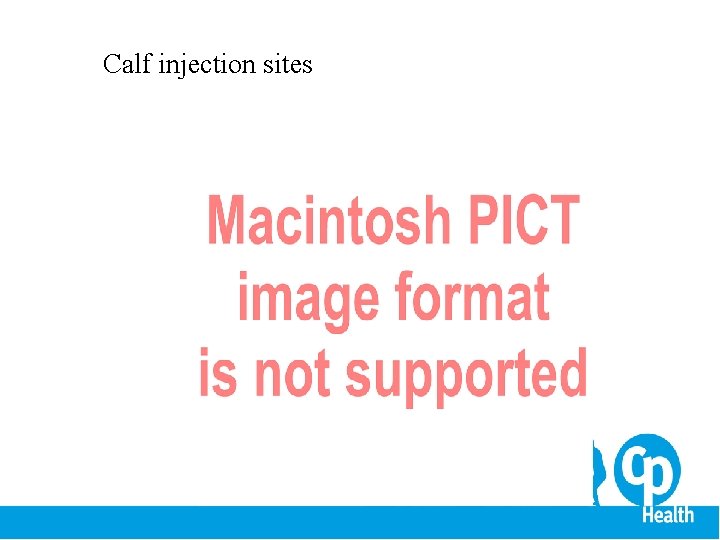 Calf injection sites 