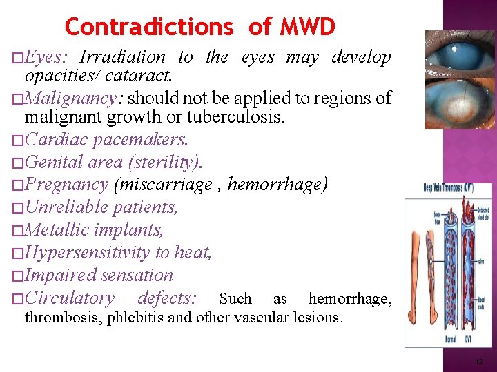 Contradictions of MWD �Eyes: Irradiation to the eyes may develop opacities/ cataract. �Malignancy: should