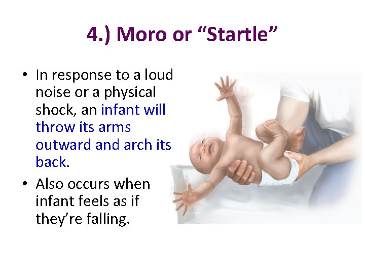 4. ) Moro or “Startle” • In response to a loud noise or a