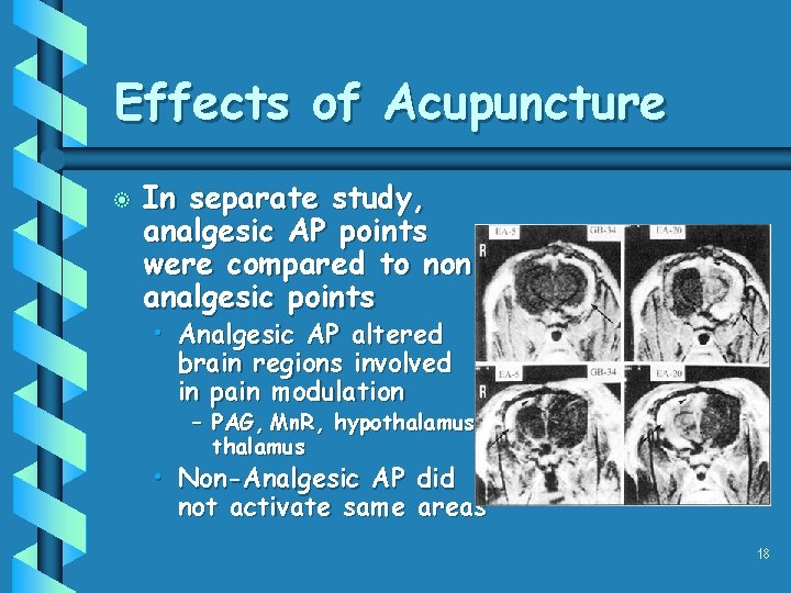 Effects of Acupuncture b In separate study, analgesic AP points were compared to nonanalgesic