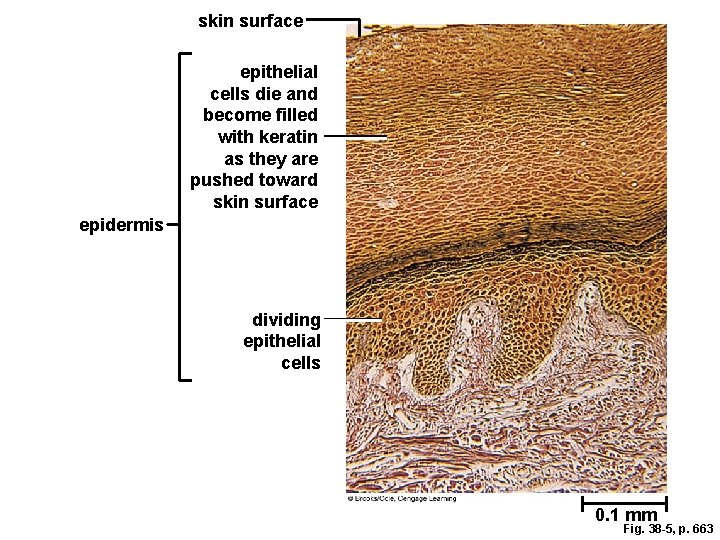 skin surface epithelial cells die and become filled with keratin as they are pushed skin surface epithelial cells die and become filled with keratin as they are pushed