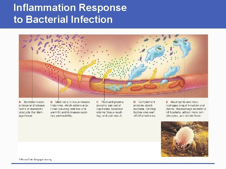 Inflammation Response to Bacterial Infection Inflammation Response to Bacterial Infection