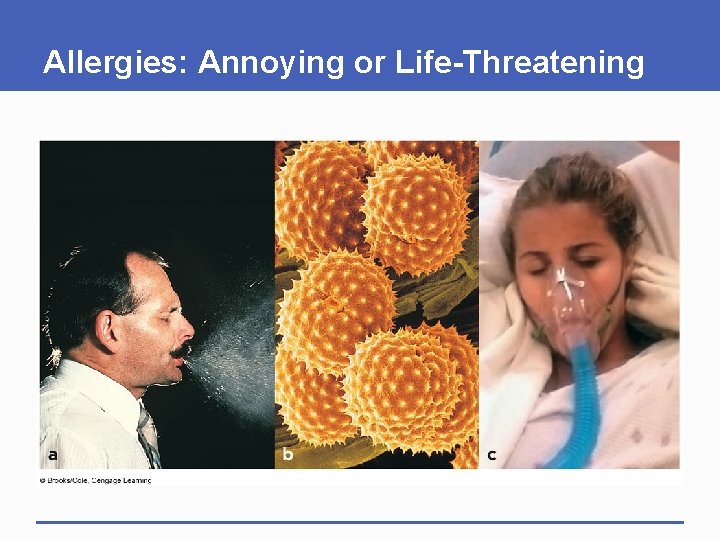Allergies: Annoying or Life-Threatening Allergies: Annoying or Life-Threatening