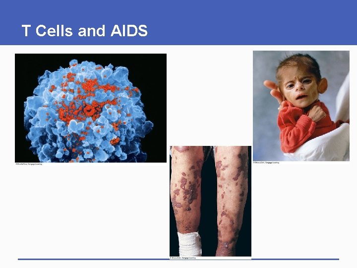T Cells and AIDS T Cells and AIDS