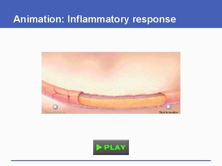 Animation: Inflammatory response Animation: Inflammatory response