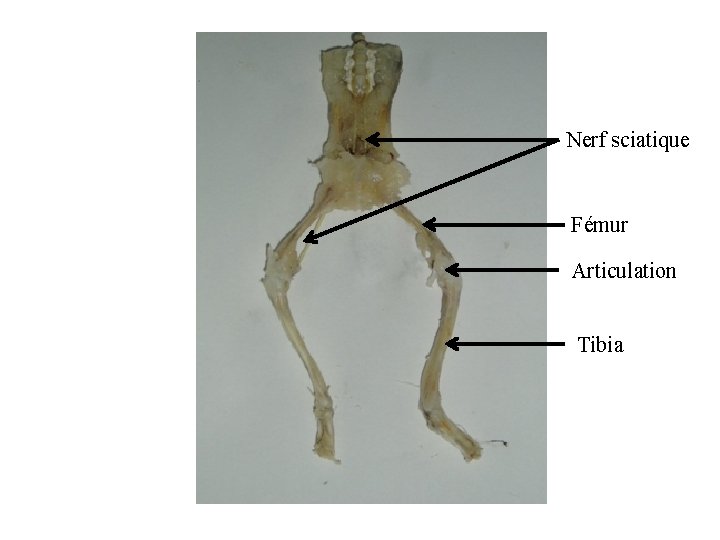 Nerf sciatique Fémur Articulation Tibia 