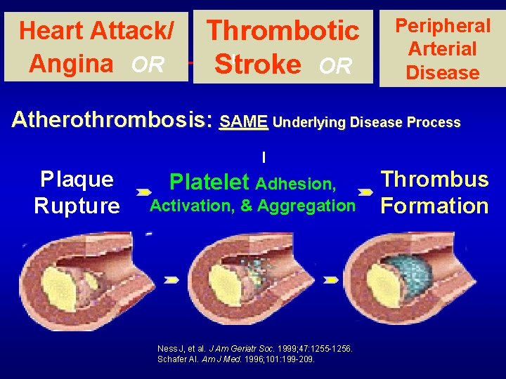Heart Attack/ Angina OR Thrombotic Stroke OR Peripheral Arterial Disease Atherothrombosis: SAME Underlying Disease