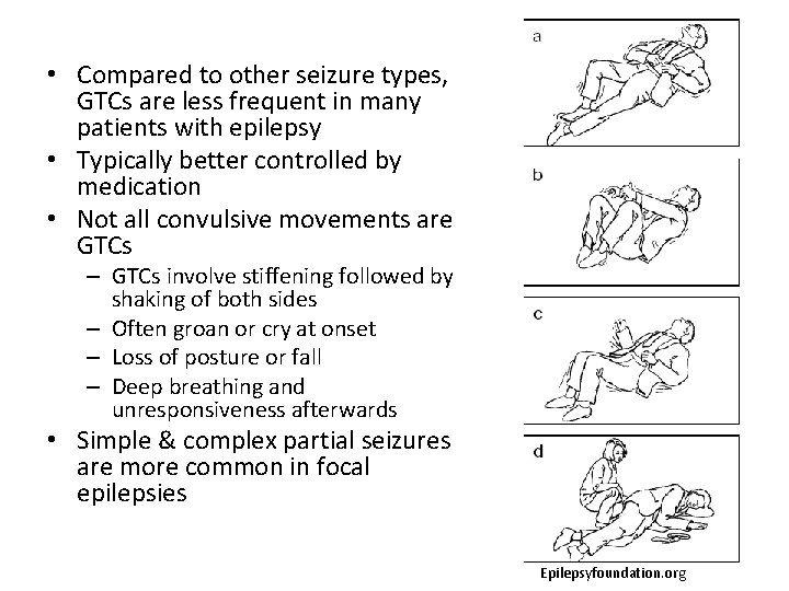  • Compared to other seizure types, GTCs are less frequent in many patients