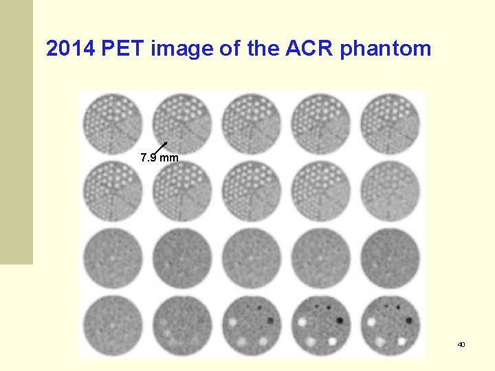 2014 PET image of the ACR phantom 7. 9 mm 40 