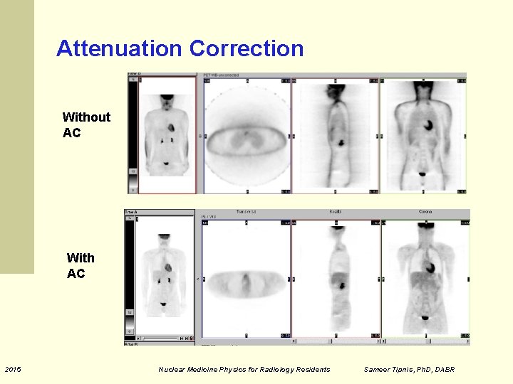 Attenuation Correction Without AC With AC 2015 Nuclear Medicine Physics for Radiology Residents Sameer