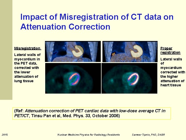 Impact of Misregistration of CT data on Attenuation Correction Misregistration Proper registration Lateral walls