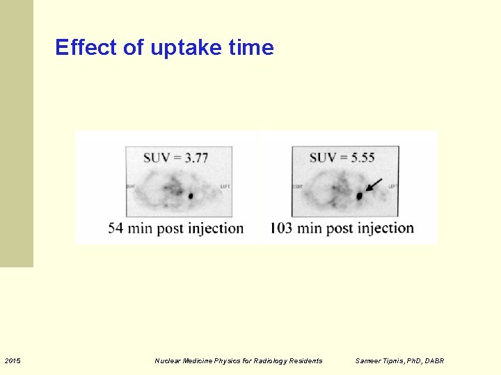 Effect of uptake time 2015 Nuclear Medicine Physics for Radiology Residents Sameer Tipnis, Ph.