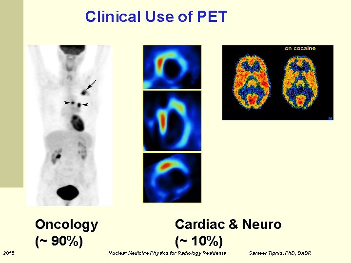 Clinical Use of PET Oncology (~ 90%) 2015 Cardiac & Neuro (~ 10%) Nuclear