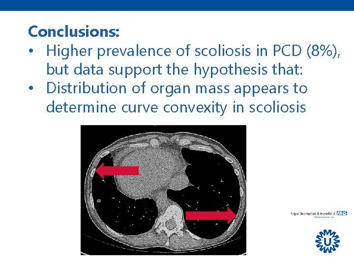 Conclusions: • Higher prevalence of scoliosis in PCD (8%), but data support the hypothesis