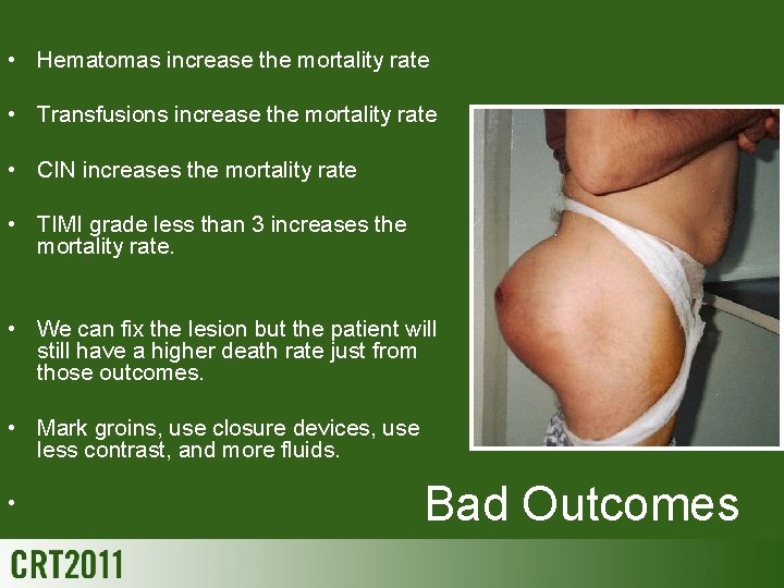  • Hematomas increase the mortality rate • Transfusions increase the mortality rate •