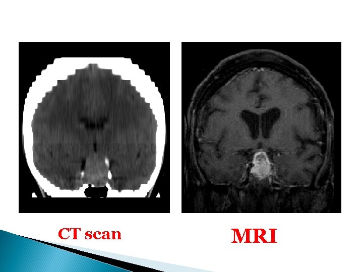 CT scan MRI 