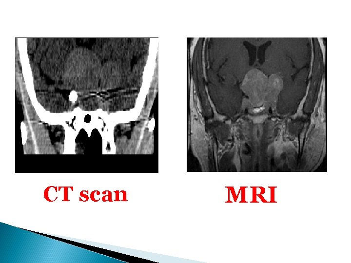 CT scan MRI 