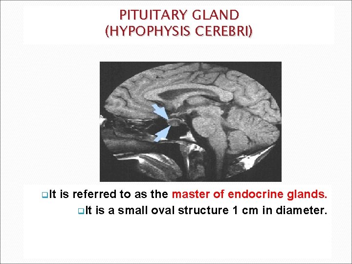 PITUITARY GLAND (HYPOPHYSIS CEREBRI) q. It is referred to as the master of endocrine