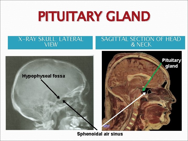 PITUITARY GLAND X-RAY SKULL: LATERAL VIEW SAGITTAL SECTION OF HEAD & NECK Pituitary gland