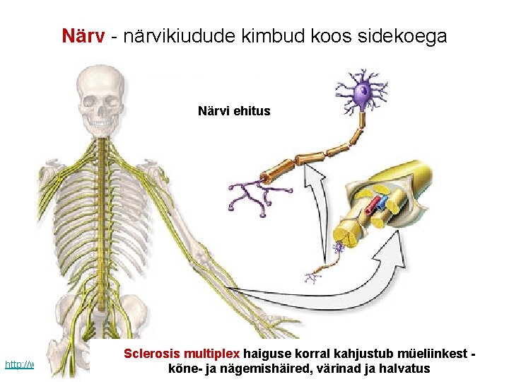 Närv - närvikiudude kimbud koos sidekoega Närvi ehitus Sclerosis multiplex haiguse korral kahjustub müeliinkest
