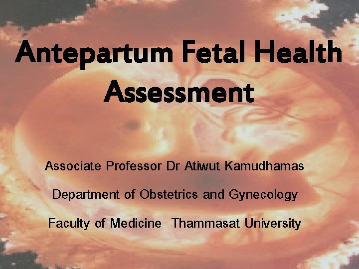 Antepartum Fetal Health Assessment Associate Professor Dr Atiwut Kamudhamas Department of Obstetrics and Gynecology