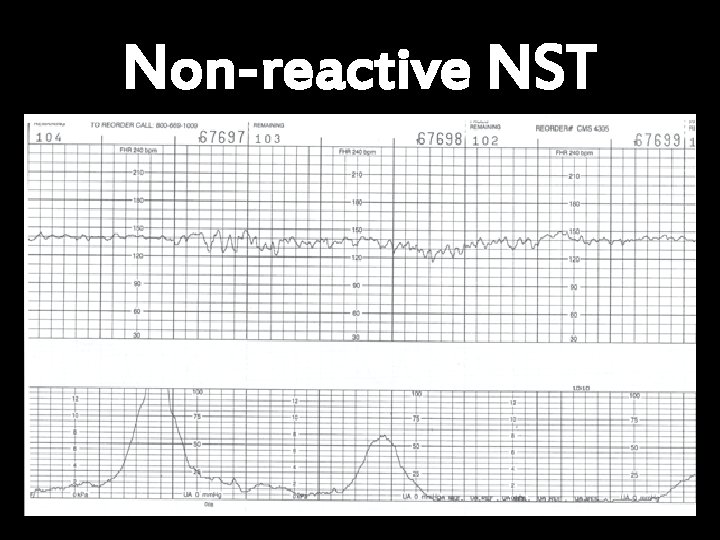 Non-reactive NST 