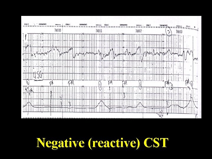 Negative (reactive) CST 