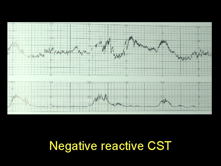 Negative reactive CST 