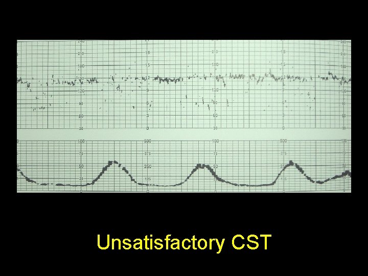 Unsatisfactory CST 