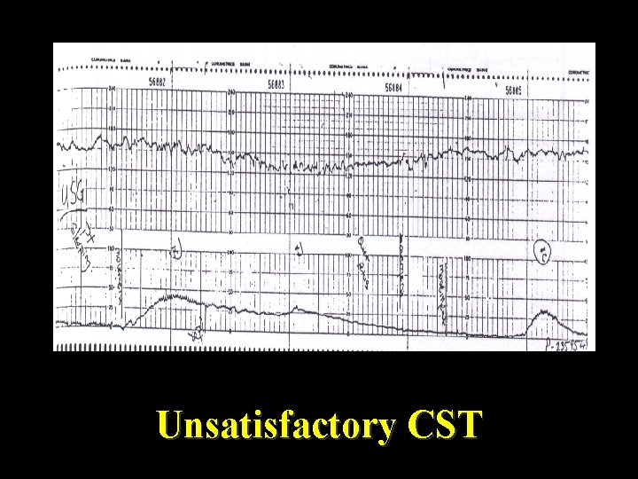 Unsatisfactory CST 