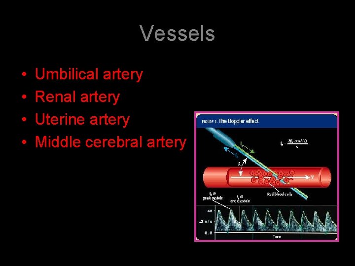Vessels • • Umbilical artery Renal artery Uterine artery Middle cerebral artery 