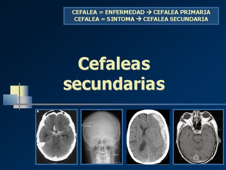 CEFALEA = ENFERMEDAD CEFALEA PRIMARIA CEFALEA = SINTOMA CEFALEA SECUNDARIA Cefaleas secundarias CEFALEA = ENFERMEDAD CEFALEA PRIMARIA CEFALEA = SINTOMA CEFALEA SECUNDARIA Cefaleas secundarias