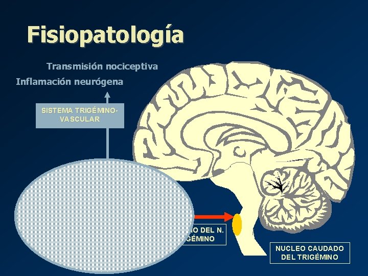 Fisiopatología Transmisión nociceptiva Inflamación neurógena SISTEMA TRIGÉMINOVASCULAR VASOS MENINGEOS ¿? GANGLIO DEL N. TRIGÉMINO Fisiopatología Transmisión nociceptiva Inflamación neurógena SISTEMA TRIGÉMINOVASCULAR VASOS MENINGEOS ¿? GANGLIO DEL N. TRIGÉMINO