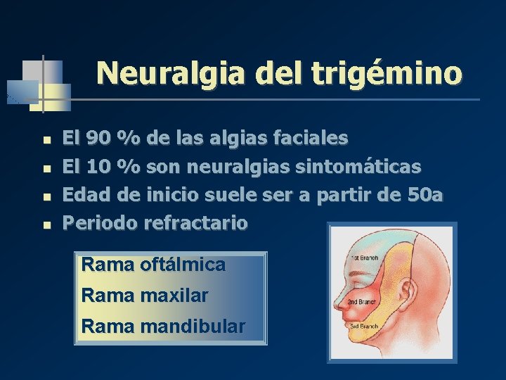 Neuralgia del trigémino n n El 90 % de las algias faciales El 10 Neuralgia del trigémino n n El 90 % de las algias faciales El 10
