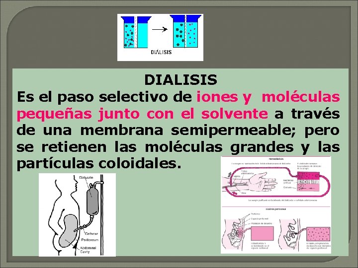 DIALISIS Es el paso selectivo de iones y moléculas pequeñas junto con el solvente