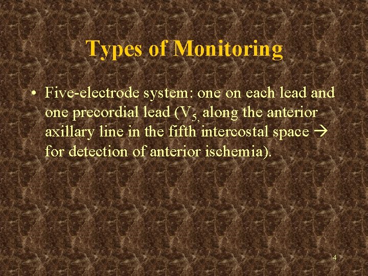 Types of Monitoring • Five-electrode system: one on each lead and one precordial lead