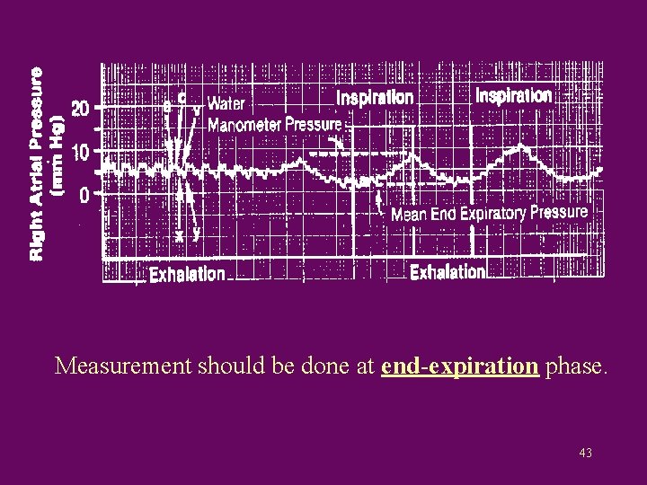 Measurement should be done at end-expiration phase. 43 