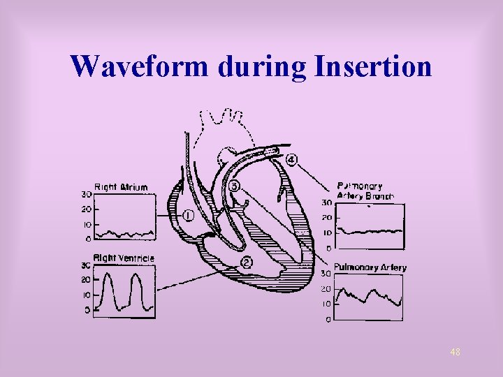 Waveform during Insertion 48 