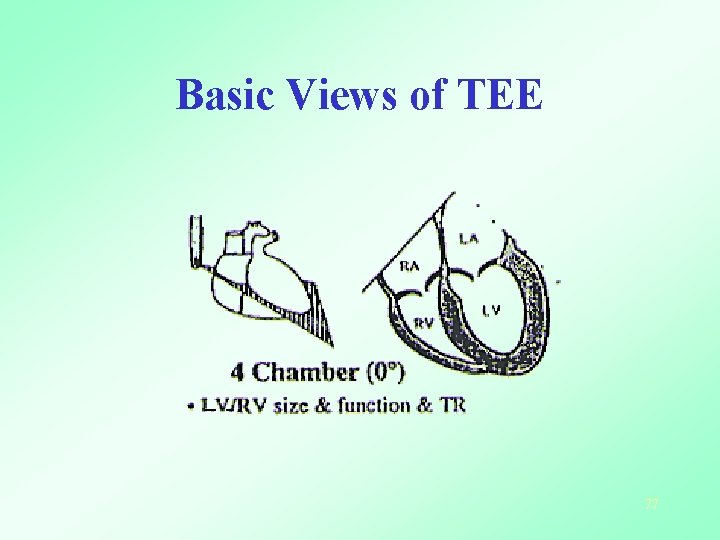 Basic Views of TEE 77 